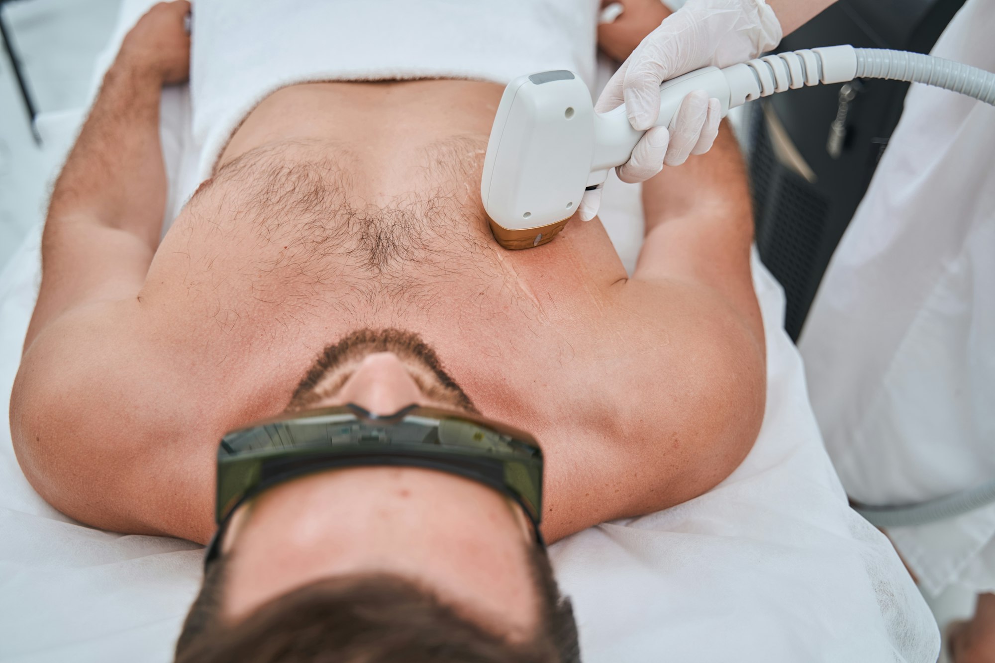 Man undergoing the laser chest hair removal